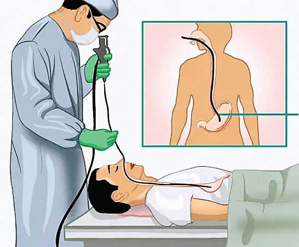 एंडोस्कोपी की जांच